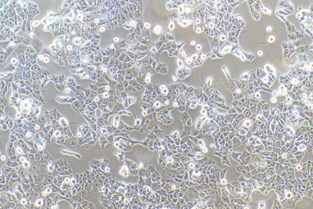 低转移人肝癌细胞MHCC97-L(STR鉴定正确)
