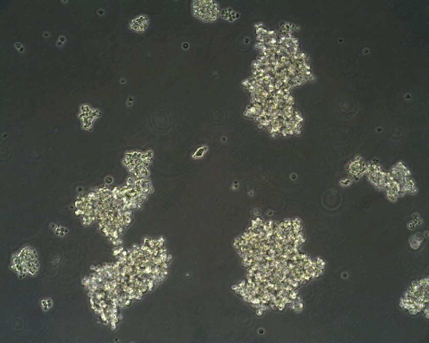 人小细胞肺癌细胞NCI-H69(STR鉴定正确)