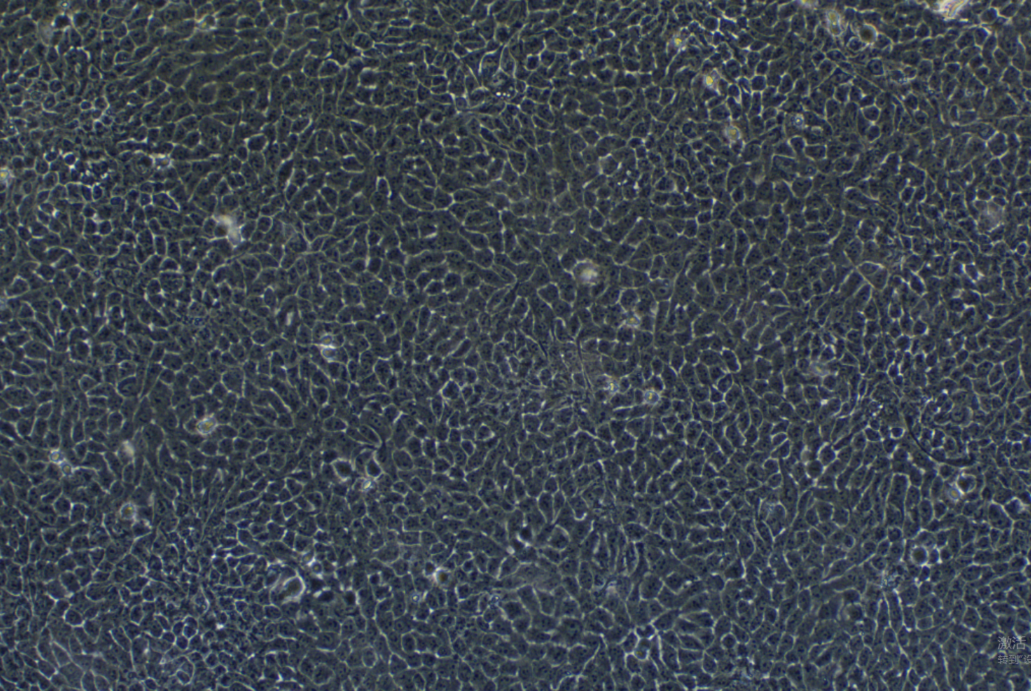 人正常乳腺上皮细胞MCF 10A (STR鉴定正确)