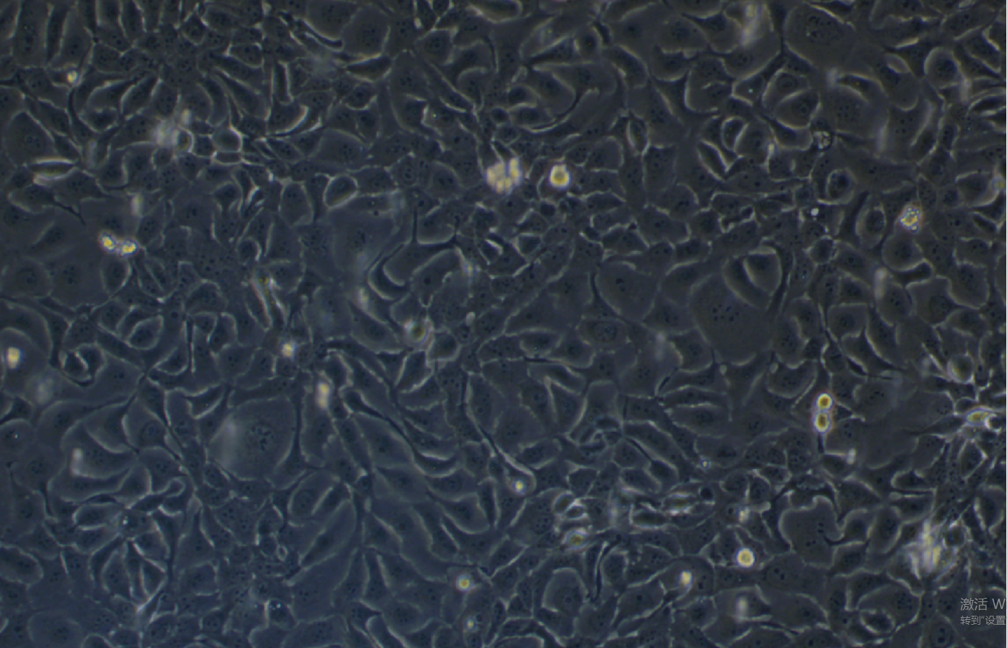 人乳腺癌细胞HCC1937(STR鉴定正确)
