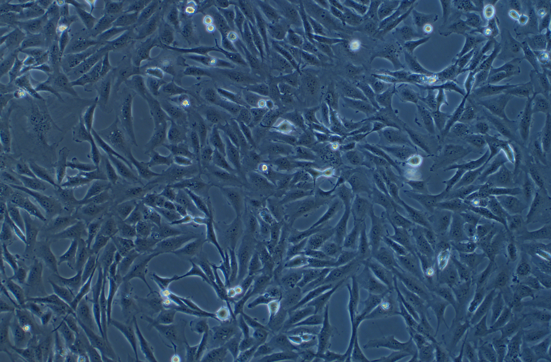 人正常人肺（支气管）上皮细胞BEAS-2B (STR鉴定正确)